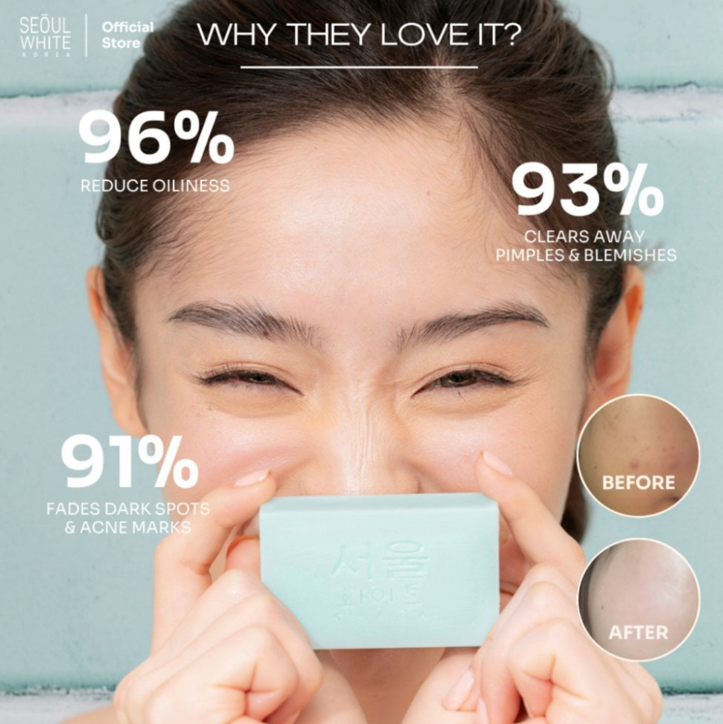 SeoulWhiteByeByeAcnePimple-FightingSoap60gx2-TeaTree&SulfurCleanser
